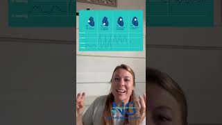 Pulmonary Artery Catheter Waveforms