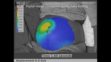 Digital Image Correlation of Baby Kicking