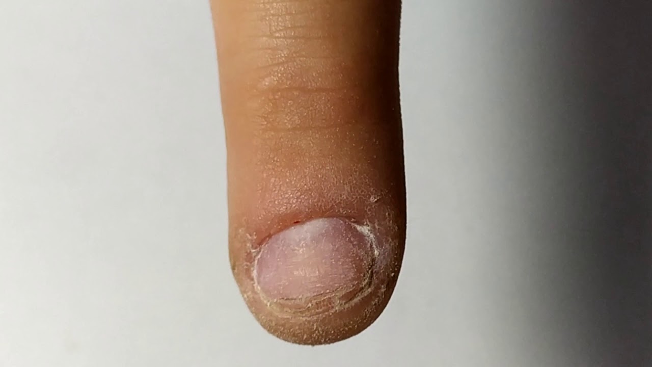 #protezareunghiiroasecupolygel