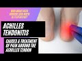 Achilles Tendonitis: Pain around the Achilles Tendon (Achilles Tendonitis Symptoms & Treatment)