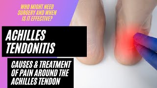 Achilles Tendonitis: Pain around the Achilles Tendon (Achilles Tendonitis Symptoms & Treatment)