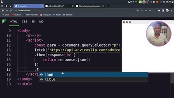 Como consumir uma API no Frontend