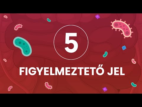 Videó: Tippek A Megfelelő Psoriasis Szakemberek Megtalálásához