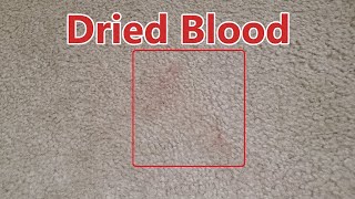 Hoover Smartwash Versus Light Blood Stains