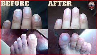 Nails Cutting & Cleaning In Philippines | Philippines Vlogs