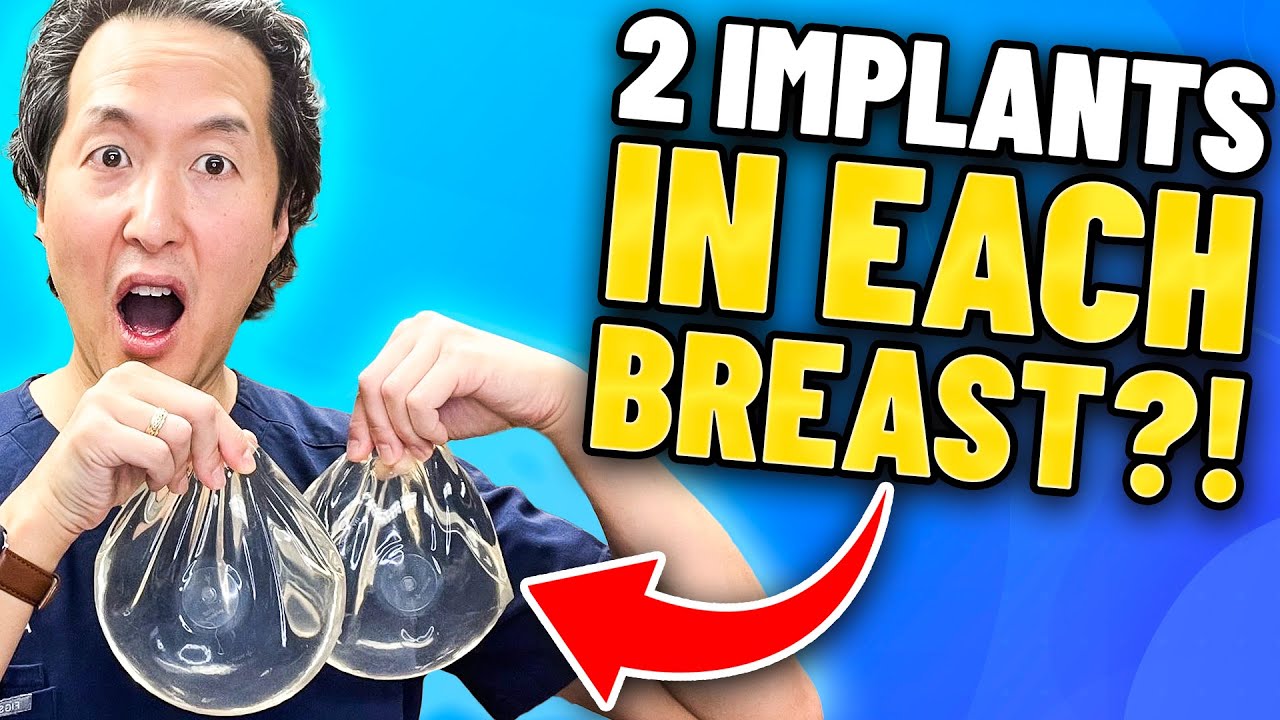 5 SHOCKING Plastic Surgery SECRETS!