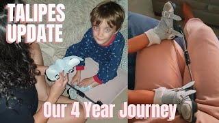 BILATERAL TALIPES UPDATE | GOODBYE BOOTS AND BAR | OUR JOURNEY | JODIE IZZO