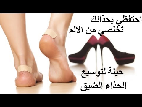 فيديو: صرير الأحذية عند المشي: ما يجب فعله للتخلص منه ، ولماذا يحدث + الصور ومقاطع الفيديو