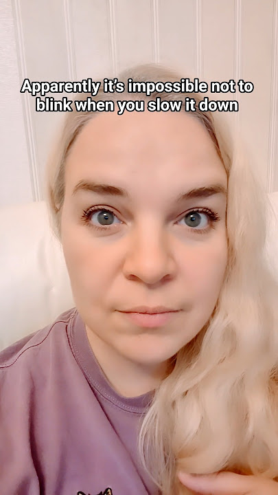 eyes are burning #shorts