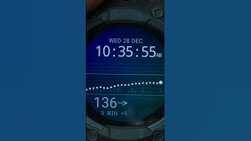 Dexcom G6/G7⌚️ Watch Face