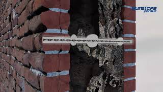 Suretwist MINI Injection Sock Anchor