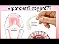 Pallil kambi idunnath malayalam  ottakambi  clear retainers fixed pallil kambi idunnath  braces