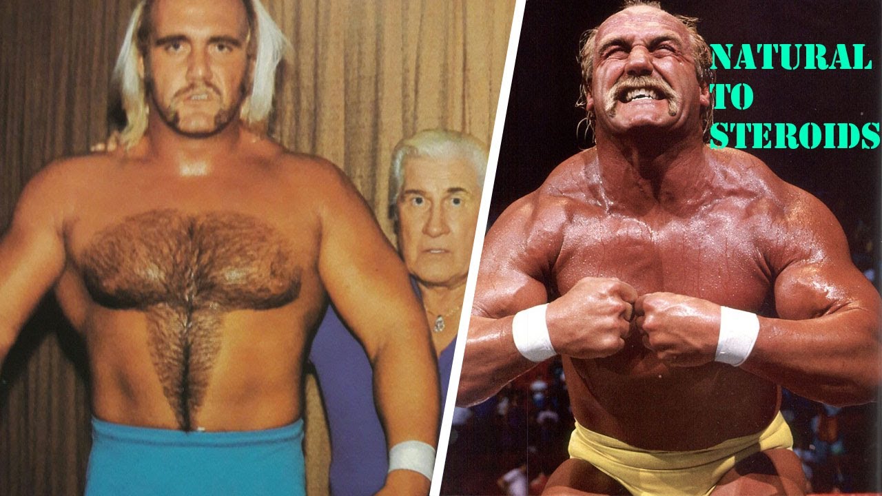 Hulk Hogan Steroid Transformation WWE, Steroids, Drugs, Steroids