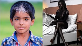 Rare Humans That Are One in a Million
