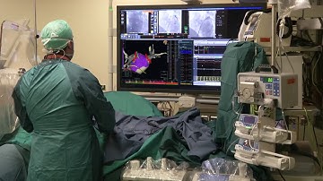 EnSite Precision™ Cardiac Mapping System: Precise, Reliable, Accurate, Fast