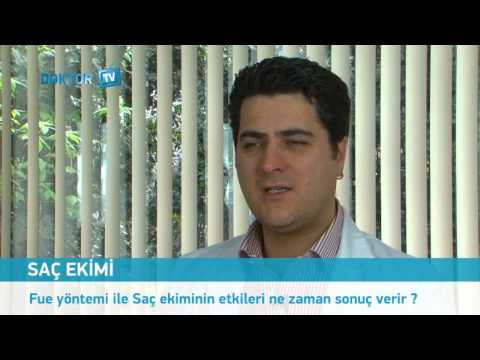 Fue Yöntemi Ile Saç Ekiminin Etkileri Ne Zaman Sonuç Verir?