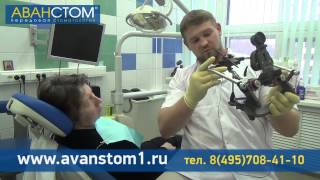 Консультация врача по имплантации зубов в клинике «Аванстом» Консультация врача по имплантации зубов в клинике «Аванстом»