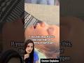Mouth Breathing? #drnalliramya #vizagdoctor #ent #vizagent #snoring #mouthbreathing #skincare