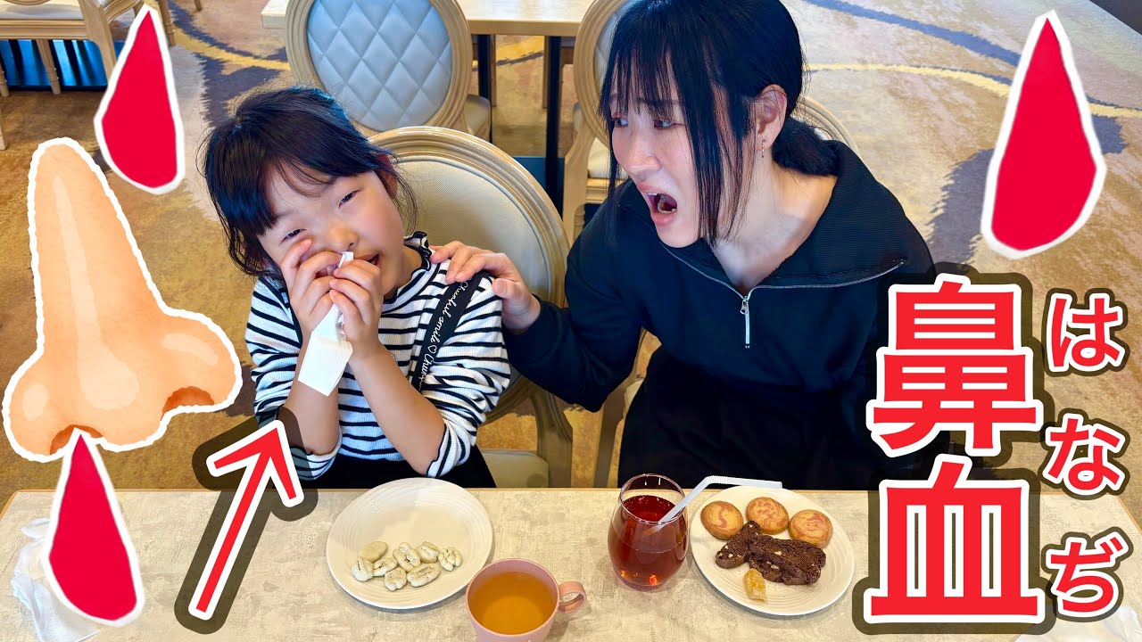 Massive nosebleed at a Disney hotel?! I want to stop it quickly