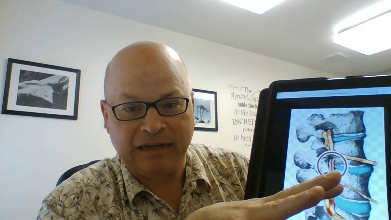 Dr Jameson explains chiropractic Pt 2 YouTube