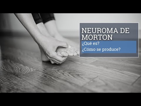 Video: Neuromatan oireiden tunnistaminen (kuvilla)