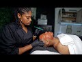 My husband gets a Micro-needling Procedure for the first time | ACNE SCARRING | VAMPIRE FACIAL