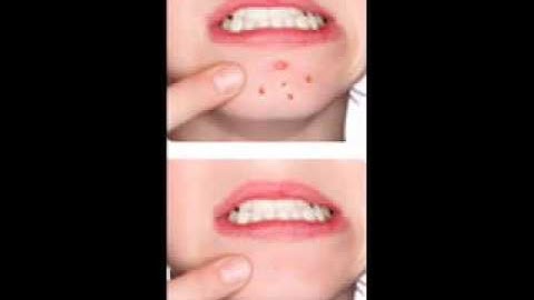 Clipping Path, Image Masking, Drop Shadow, Raster to Vector Samples