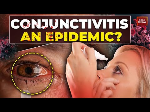 Conjunctivitis Cases On The Rise: How Does Pink Eye Spread?