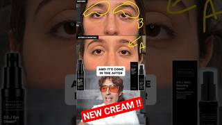 New Cream Tightens Eyelids and Lifts ! @rajanimdskincare