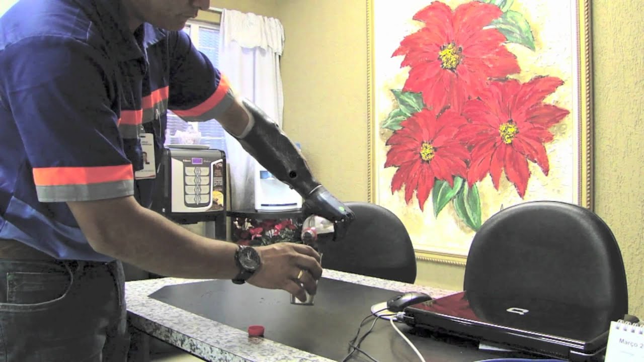 Prótese Biônica - Sr. Jose Nilton l Conforpés