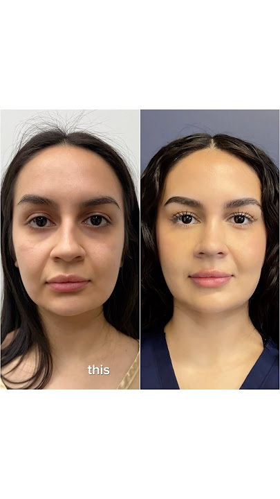 Doctor Made Her Look HOT 😍 24 Year Old Gets Plastic Surgery!