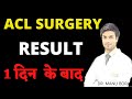 Acl internal brace surgery 1 day results drmanu bora