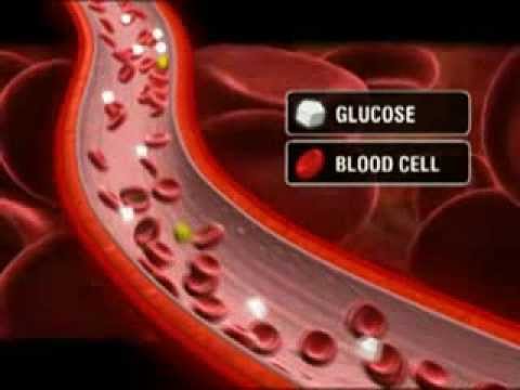 Vídeo: Furúnculos Diabéticos: O Diabetes Causa Furúnculos?