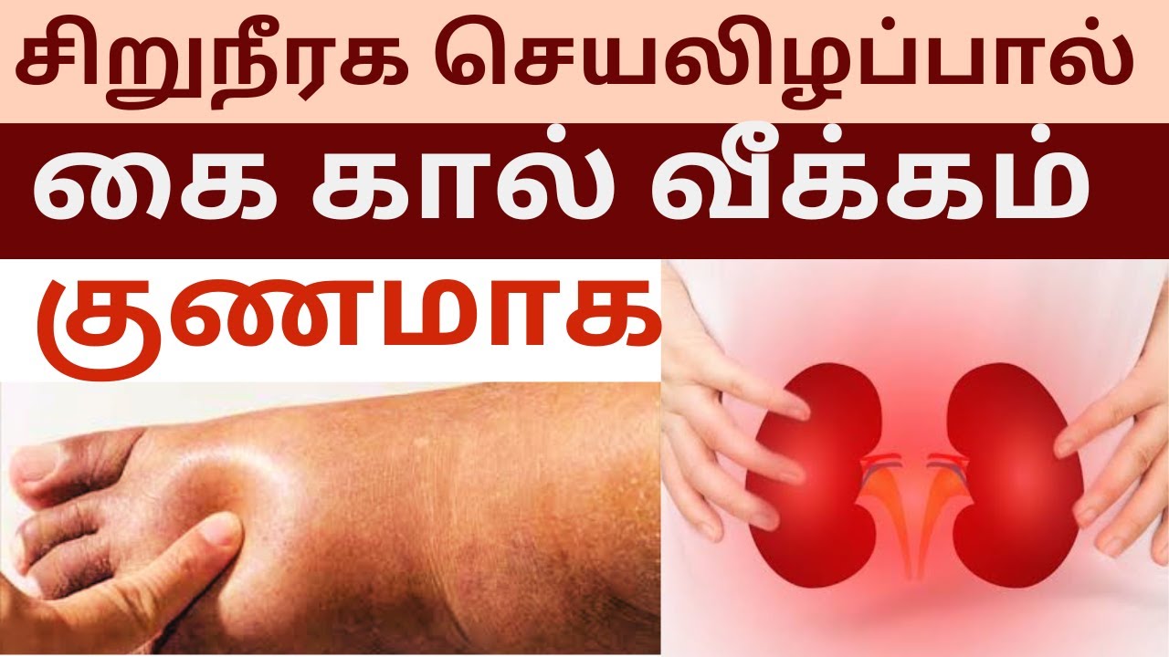 What Causes Edema In Kidney Failure Tamil YouTube What Causes Edema In Kidney Failure Tamil YouTube