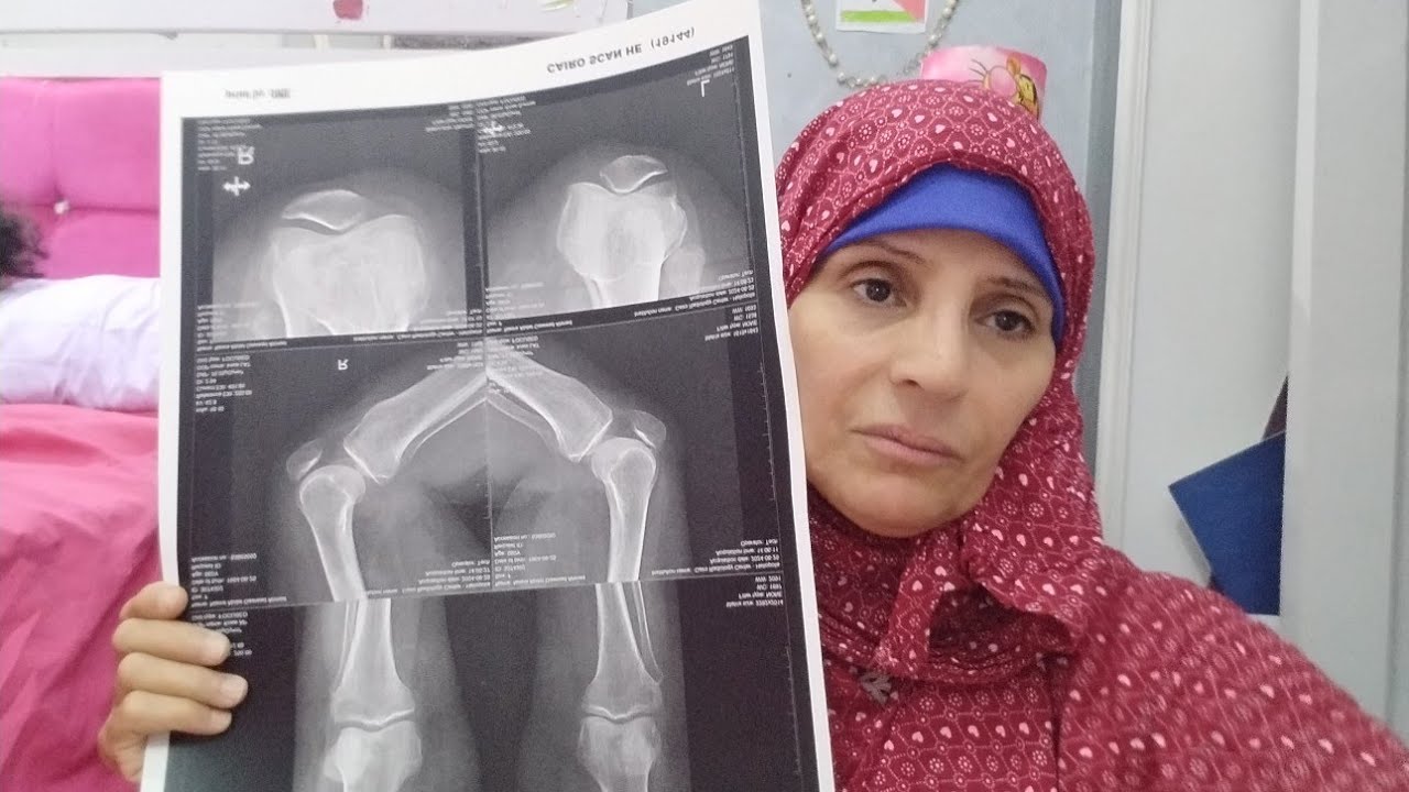 الحمد لله ربنا بعث لي هديه اللهم لك الحمد.. الدكتور قال لي ما لكيش دواء.. اللي يعرف ليا دواء يقول لي