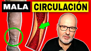 ¿Cuáles son los signos de mala circulación en las piernas?