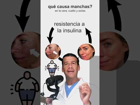 Manchas en la cara y cuello se pueden aclarar.