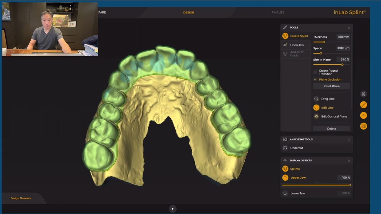 Primeprint Occlusal Splint Workflow