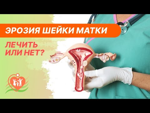 👉 Эрозия шейки матки - лечить или нет?