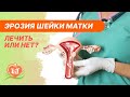 👉 Эрозия шейки матки - лечить или нет?