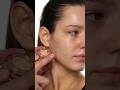 How To Cover Acne 