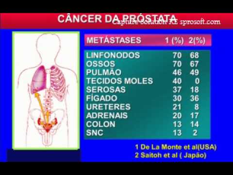 adenocarcinoma de próstata