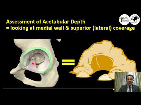 Video: Hoe vorm asetabulum?