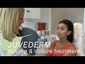 Juvederm voluma  juvederm vollure treatment demonstration  skin by lovely