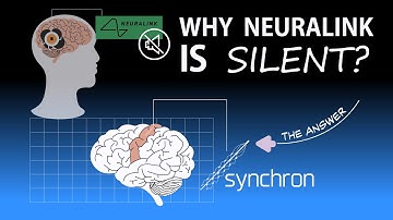 Neuralink Is Falling Behind… Synchron Is Leading the BCI Race