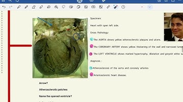 Jars Path 210 2nd YR Kasr Al-Ainy by Ahmed Hamdy Part 1