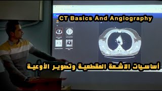 أساسيات الاشعة المقطعية وتصوير الأوعية | CT Basics And Angiography screenshot 4