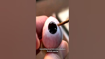 Bionic Vision, Merging Technology and Biology to Restore Sight. #bionics #vission #sight