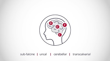 Medical Explainer Video | 2D Infographic Animation