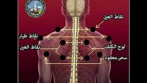الرقيه الشرعيه للشيخ احمد السقاف ابو عبد العزيز24-1-2017-asar